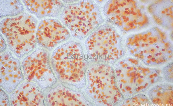 хлоропласты под микроскопом