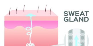 Ангидроз: причины, принципы диагностики и лечения