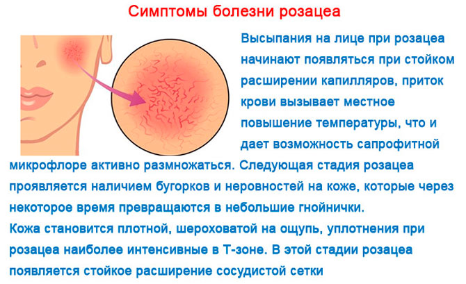 Причины прыщей на подбородке у женщин