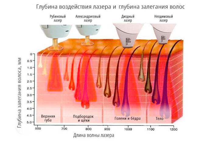 Воздействия лазера на кожу