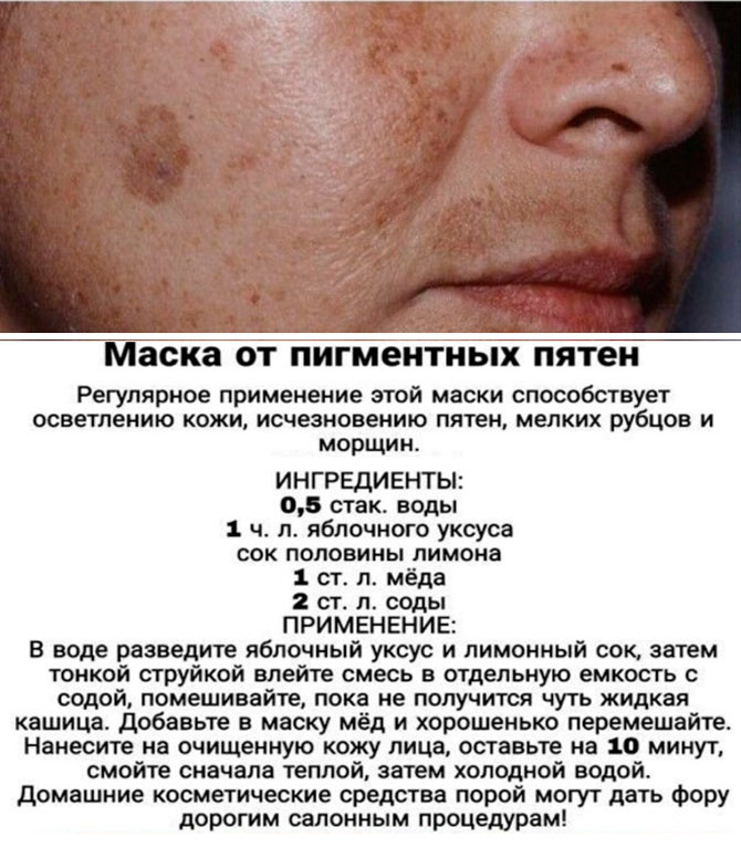 Как быстро убрать пятна после прыщей на лице: лучшие методы