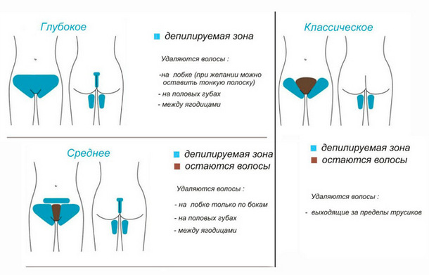 Использование полосок для депиляции в зоне бикини