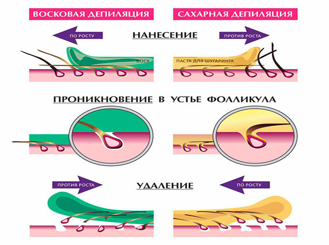 Схема шугаринга